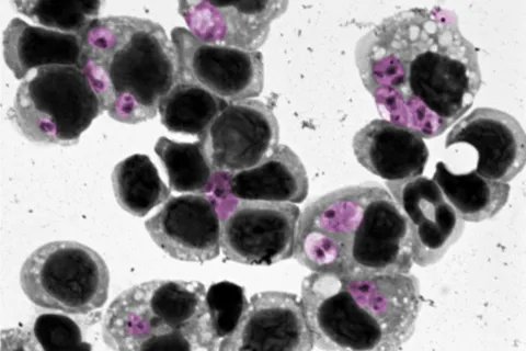 close-up of leishmaniasis